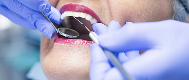 Best Emergency Broken Tooth Repair in Pelahatchie, MS
